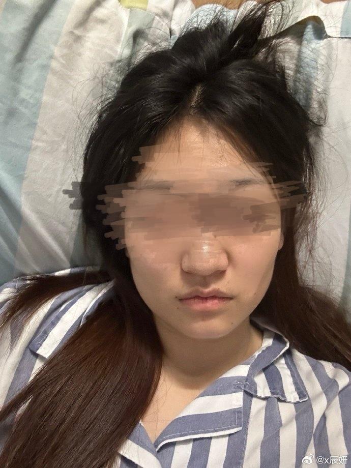 小徐浙江永康公厕遭殴打事件求助_小徐白血病治疗费用困难_公厕被打女孩家庭已无力承担医疗费