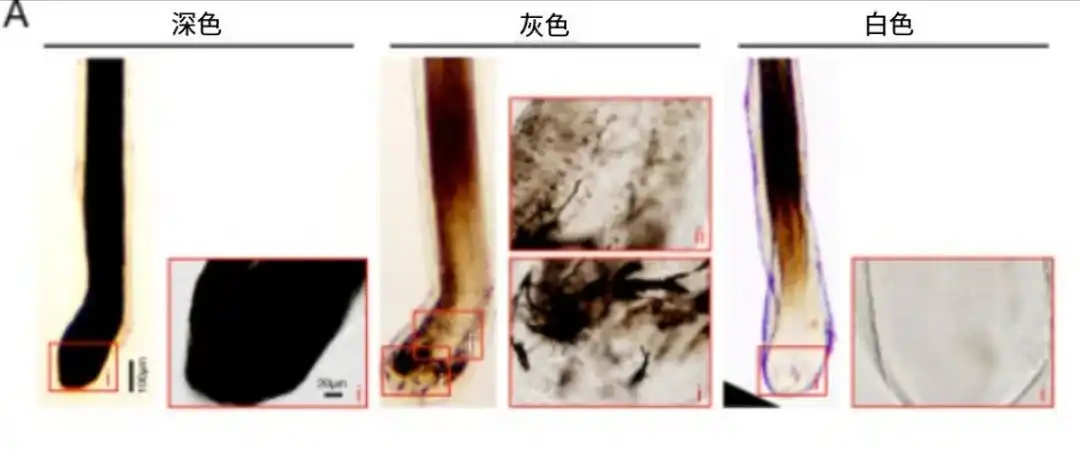 头发重新变黑的方法找到了_头发颜色变化与生活压力_白头发与压力关系